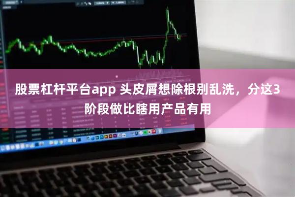 股票杠杆平台app 头皮屑想除根别乱洗，分这3阶段做比瞎用产品有用
